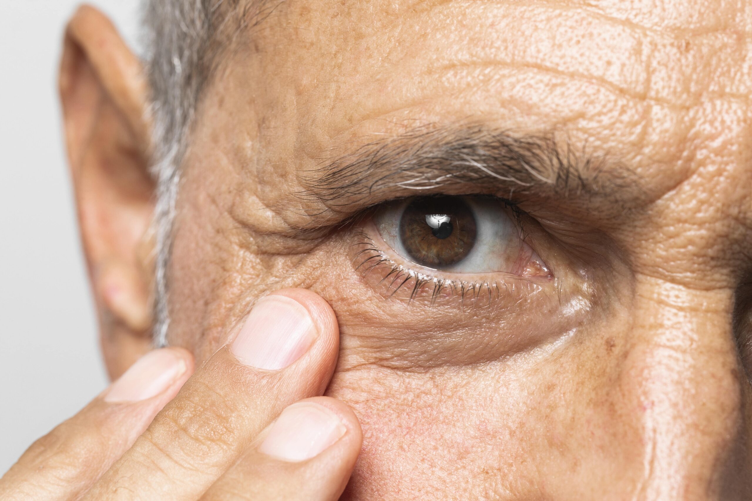 Cataract surgery about