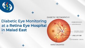 Diabetic Eye Monitoring at a Retina Eye Hospital in Malad East