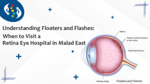 Understanding Floaters and Flashes: When to Visit a Retina Eye Hospital in Malad East